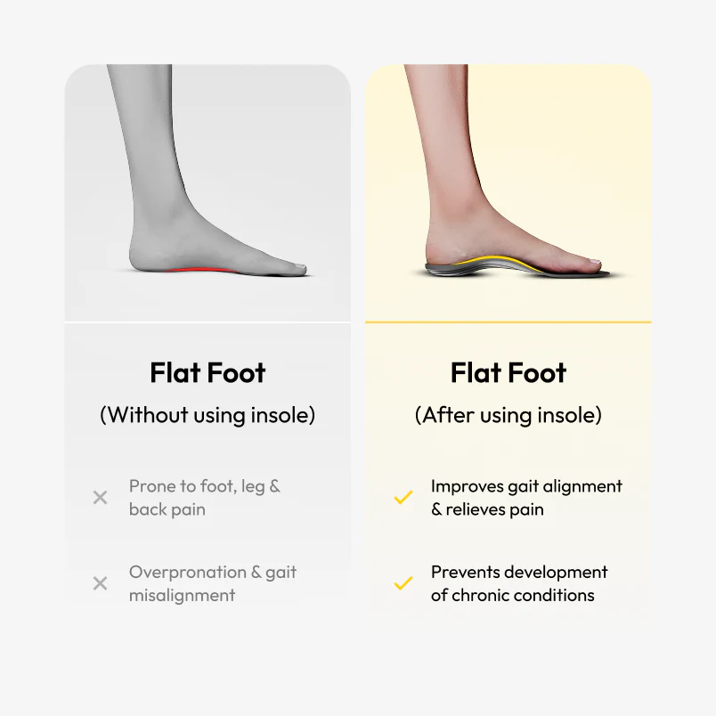 Frido Arch Support Insoles Rigid + Semi Rigid Combo - Image 6