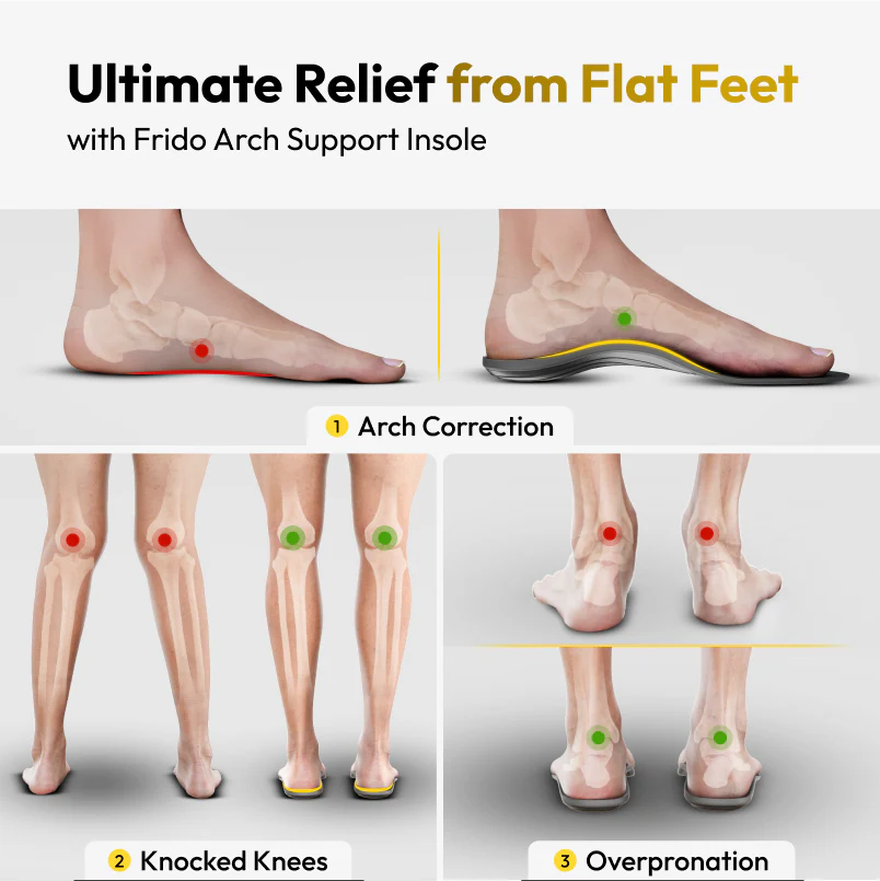Frido Arch Support Insoles Rigid + Semi Rigid Combo - Image 7