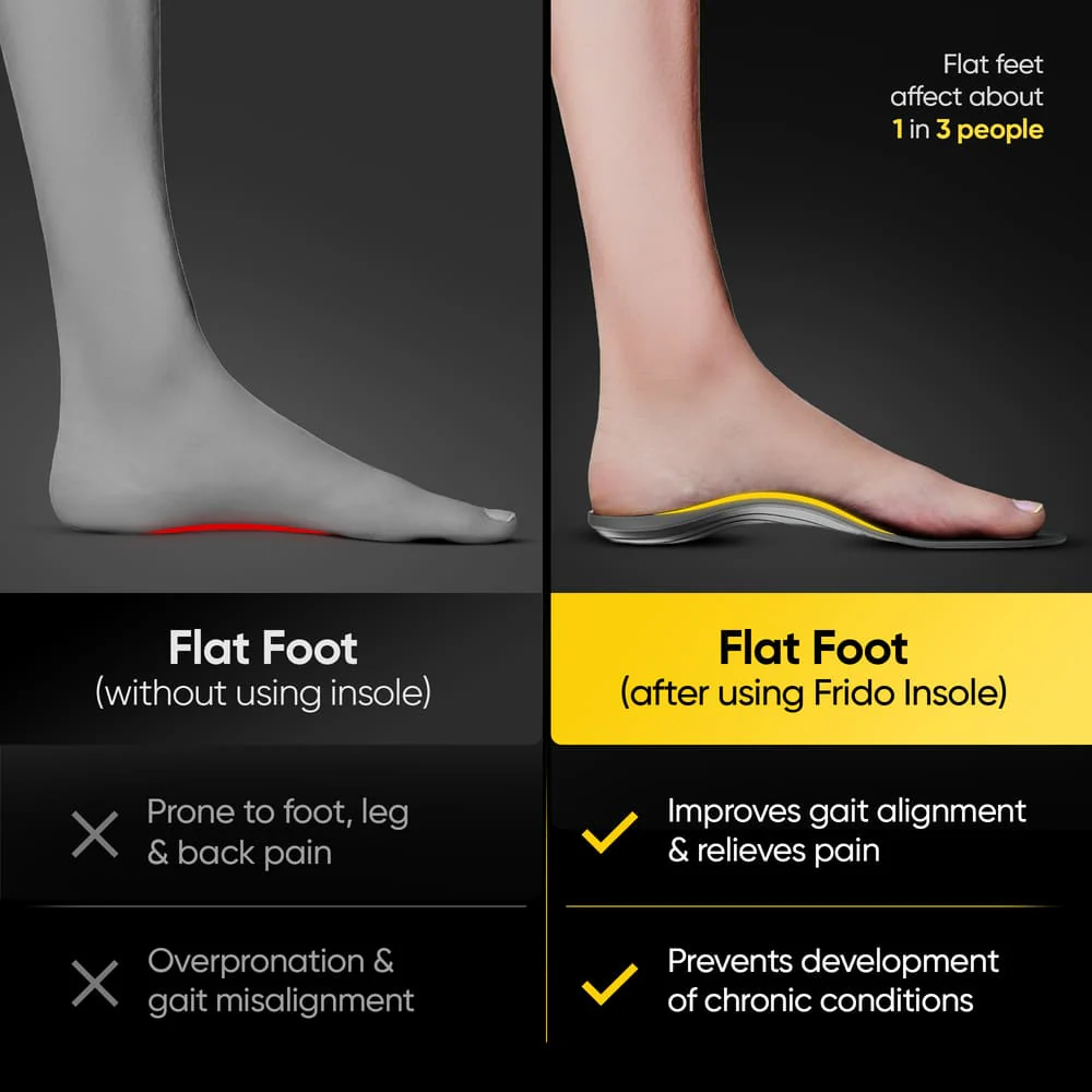 Frido Arch Support Insoles - Image 3