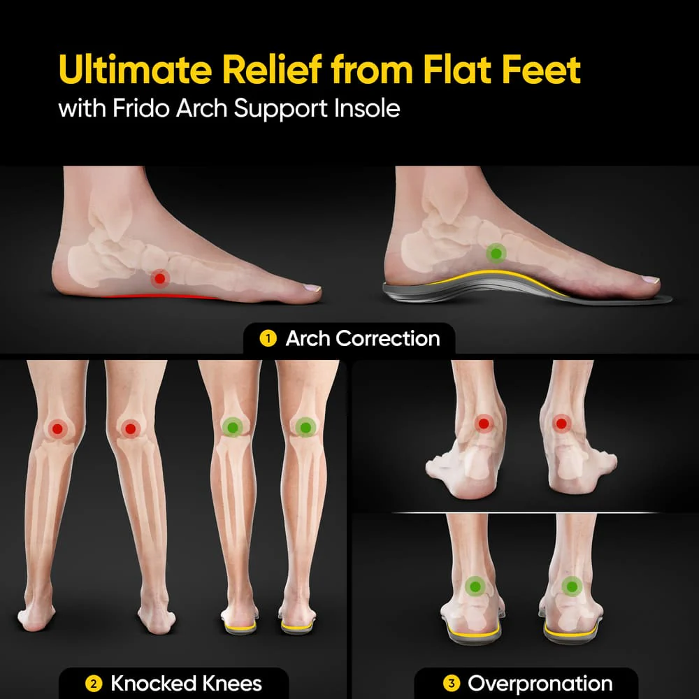 Frido Arch Support Insoles - Image 4