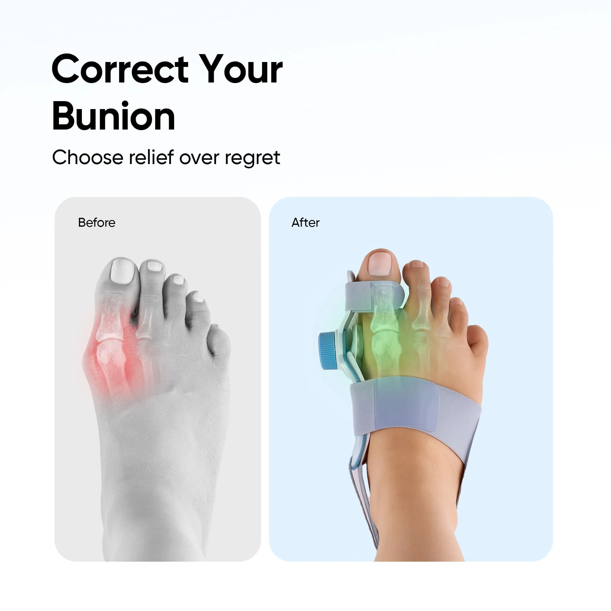 Frido Orthotics Bunion Corrector - Image 3