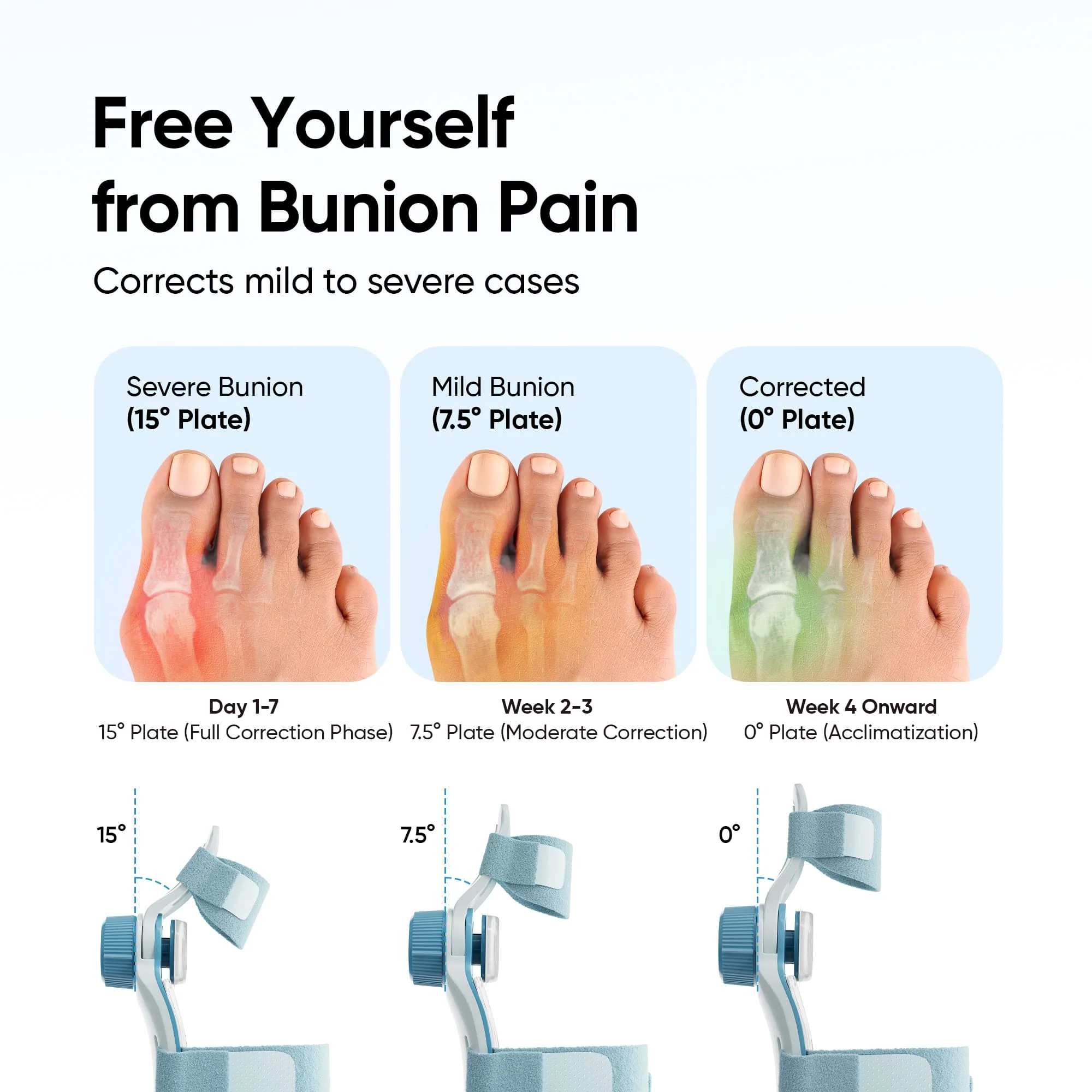 Frido Orthotics Bunion Corrector - Image 4